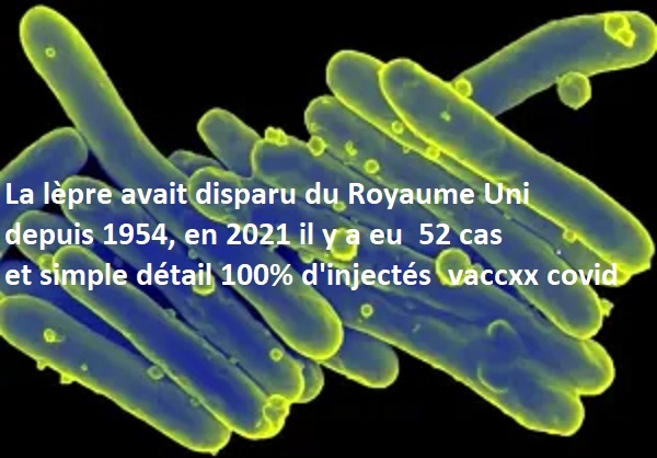 Cette image a un attribut alt vide ; le nom du fichier est leprosy-vaccination.jpg