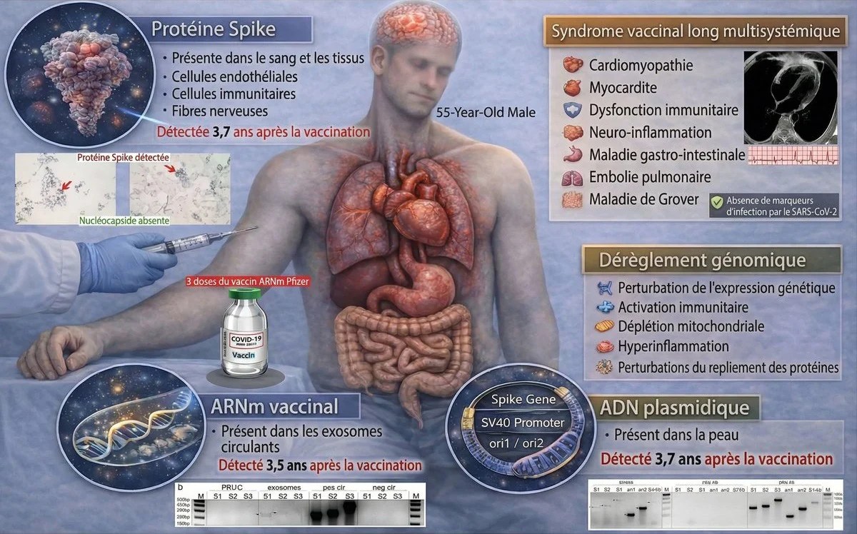 Spikeopathies/les dégâts liés aux covids longs ( viraux et post vaccinaux ) plus nombreux et plus graves qu’on ne dit, renouvelés à chaque injection